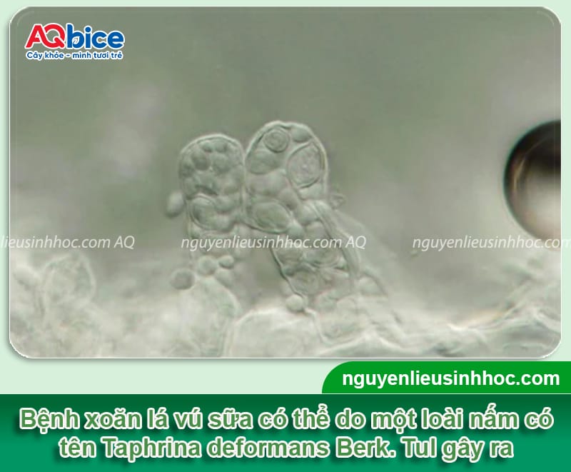 Cây vú sữa bị xoăn lá nguyên nhân do đâu & Cách phòng trị