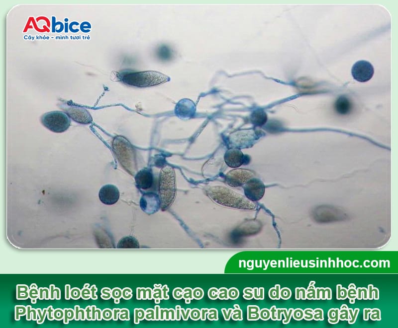 Loét sọc miệng cạo cao su: Dấu hiệu & Cách xử lý dứt điểm 2 Loét sọc miệng cạo cao su: Dấu hiệu &; Cách xử lý dứt điểm