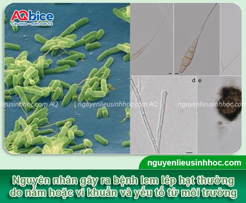 Thuốc đặc trị bệnh lem lép hạt trên lúa hiệu quả nhanh chóng 3 Chọn loại thuốc đặc trị bệnh lem lép hạt trên lúa hiệu quả
